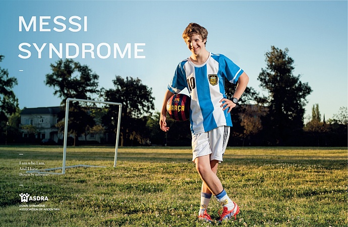 ASDRA: Messi syndrome