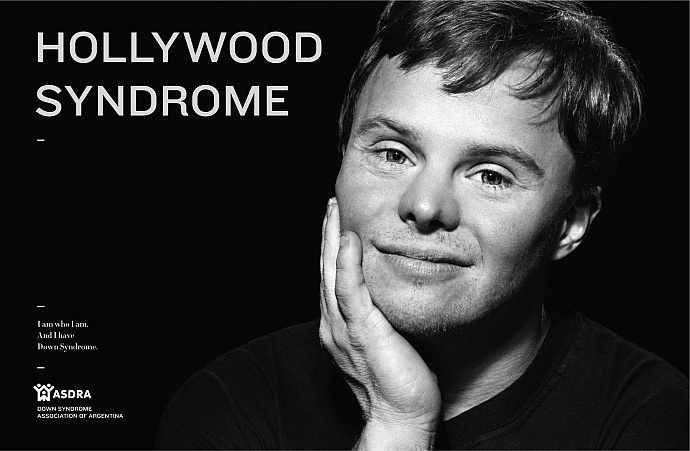 ASDRA: Hollywood syndrome