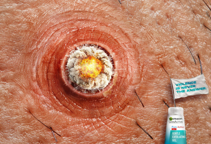 Garnier: Skin Violence, 1
