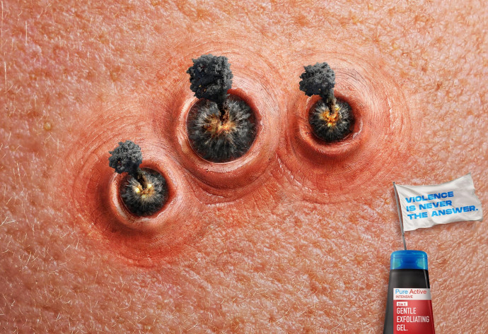 Garnier: Skin Violence, 2