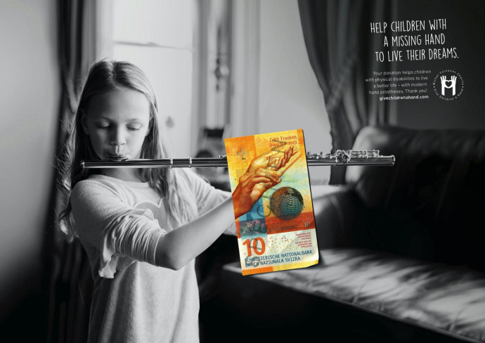 Give Children a Hand: Help children with a missing hand, 1