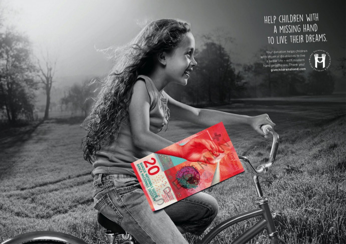 Give Children a Hand: Help children with a missing hand, 2