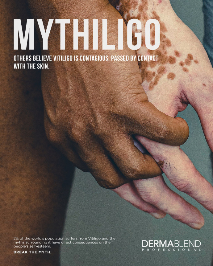 Dermablend: Mythligo, 1
