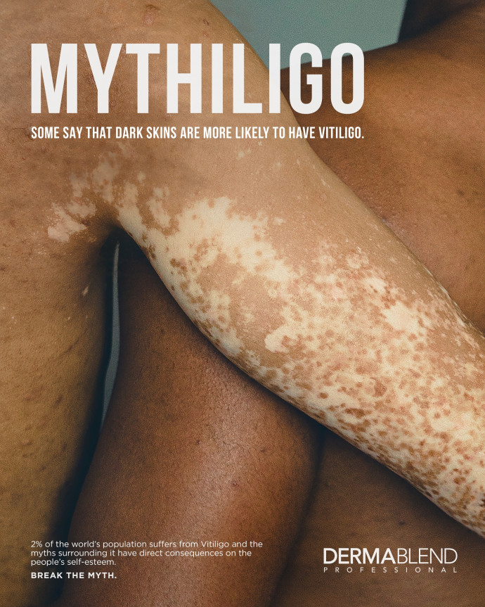Dermablend: Mythligo, 3