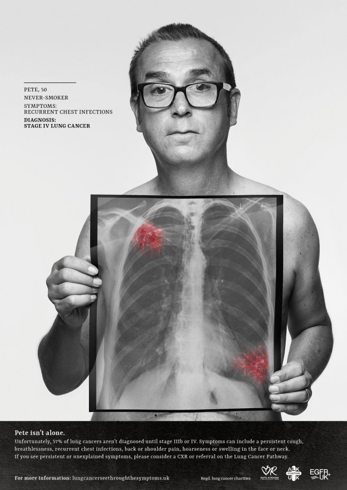 ALK Positive UK / Ruth Strauss Foundation / EGFR Positive UK: See Through The Symptoms, 3