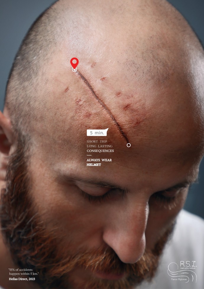 R.S.I. - Road Safety Institute: Scars, 1