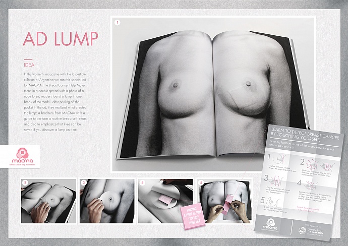 MACMA: Ad lump